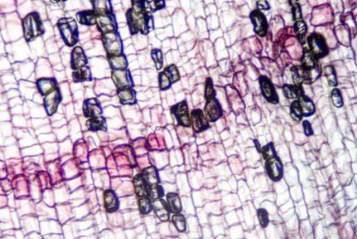 <ul><li><p>also called peridem</p></li><li><p>replaces the epidermis on older woody stems and roots. This tissue is several cell layers thick, consisting of __ cells. Contains a lot of suberin wax within their thick cell walls and usually are dead at maturity</p></li><li><p>act as a protective barrier and to prevent water loss</p></li></ul><p></p>