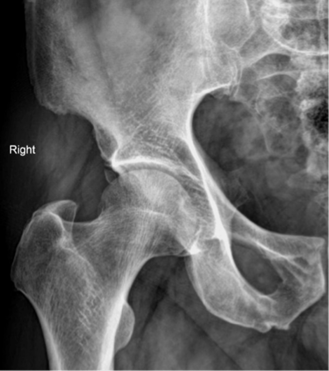 <p>Can you adjust this patient?</p>
