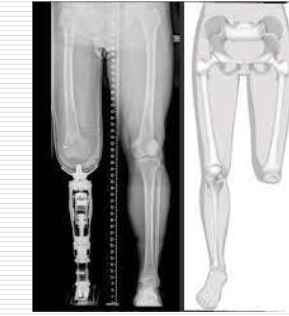 <p>What is the discrepancy here?</p>