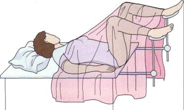 <p><span style="background-color: transparent;"><span>Lithotomy</span></span></p>