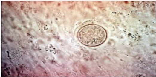 <p>Microscopy to identify spherules in tissues </p>