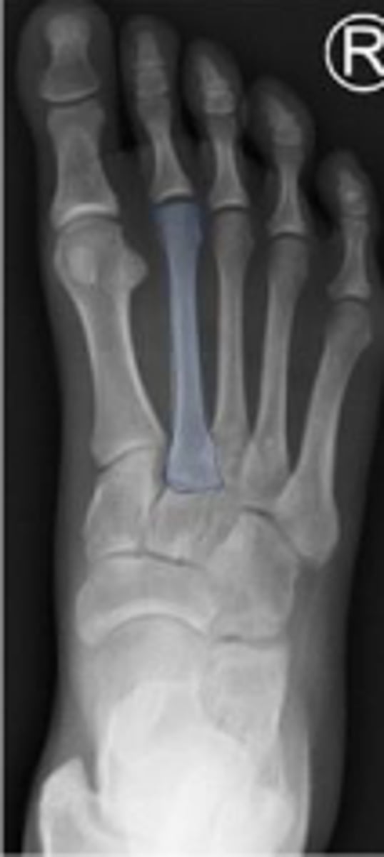 <p>What is outlined?</p>