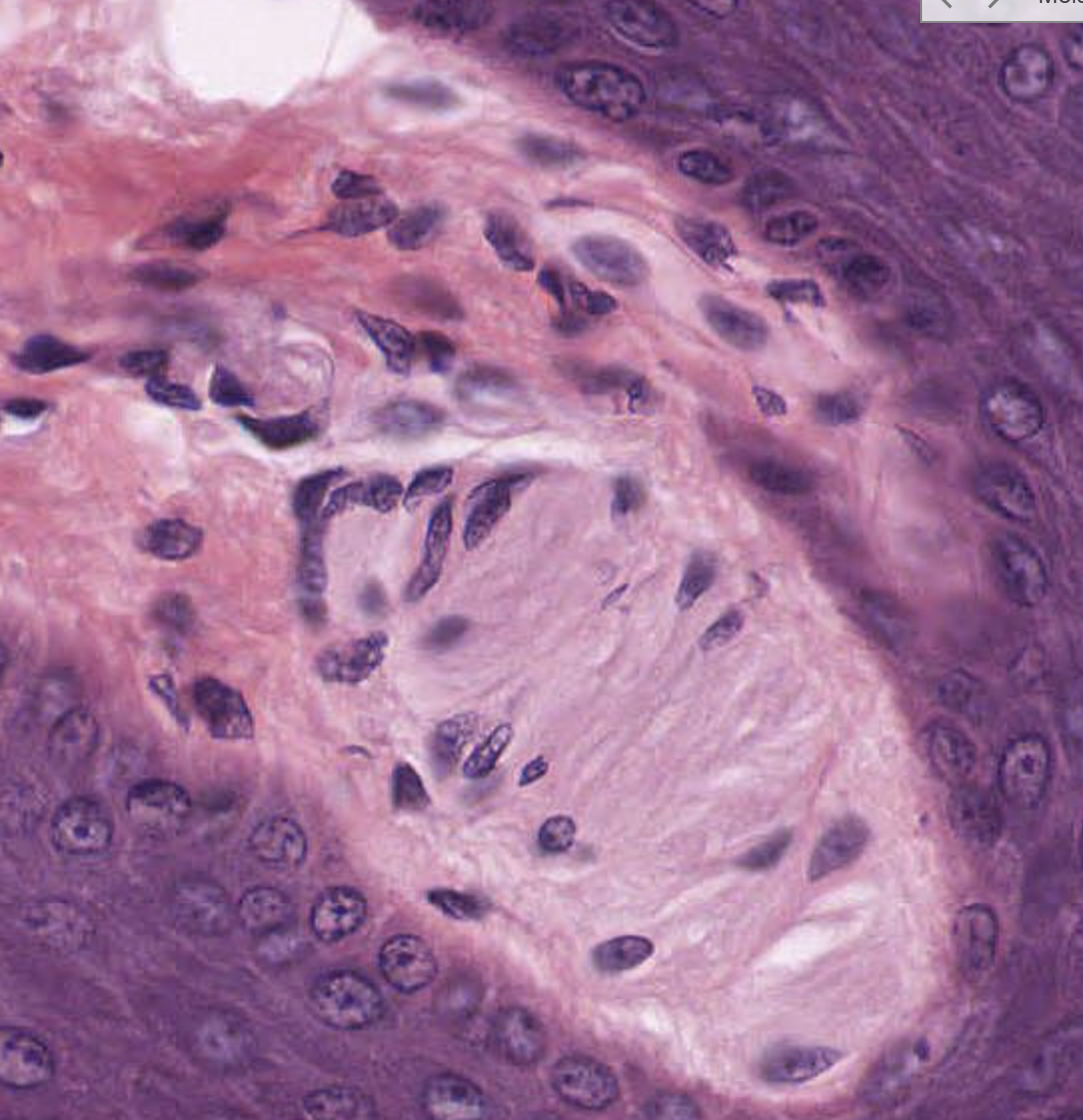 term image