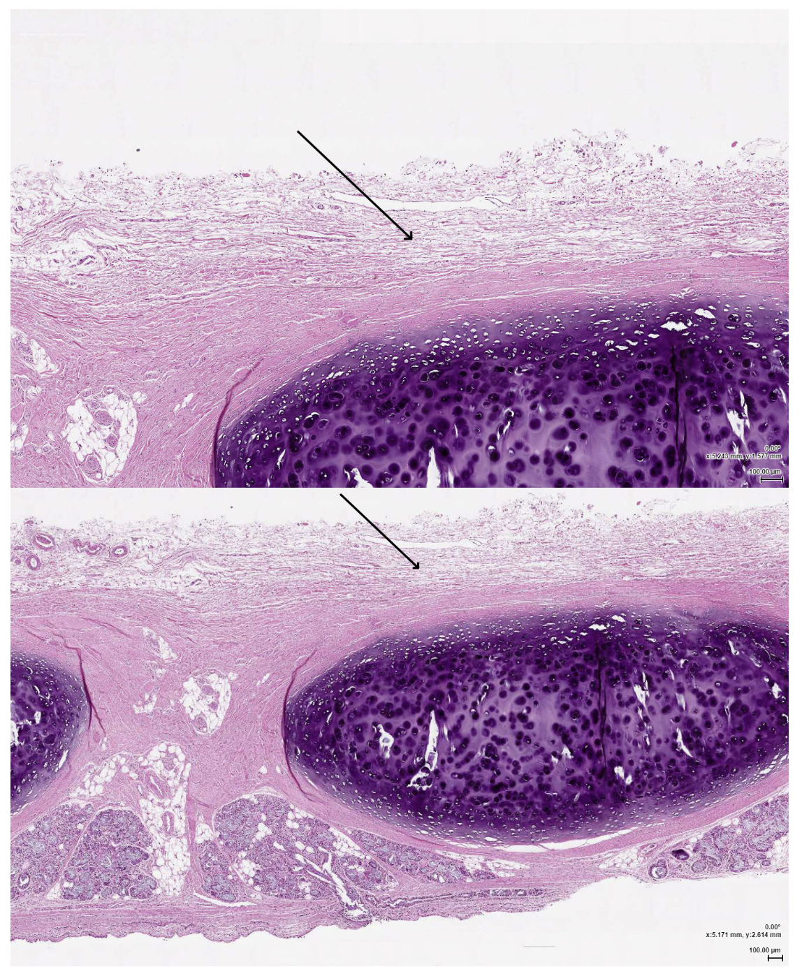 <p><span><span>The layer indicated by the arrow is primarily composed of which of the following?</span></span></p>