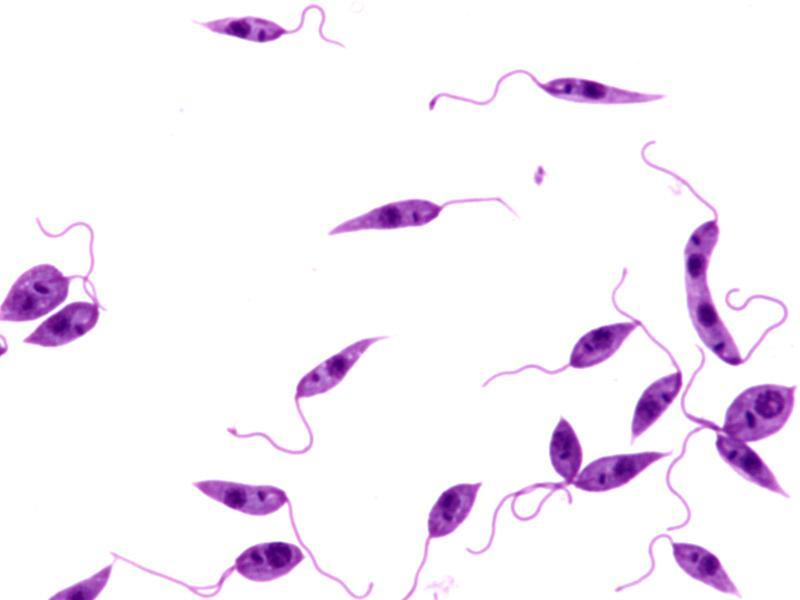 <p>Leishmania donovoni </p>