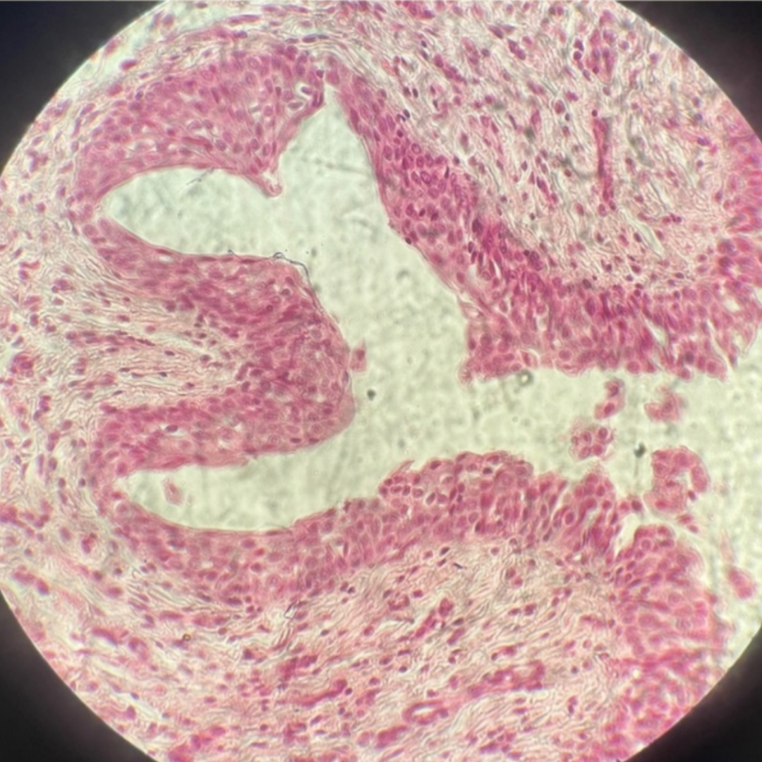 term image