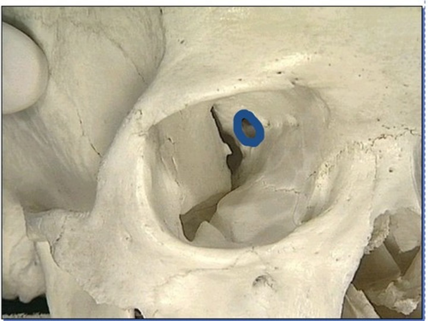 <p>1. In the lesser wing of sphenoid</p>