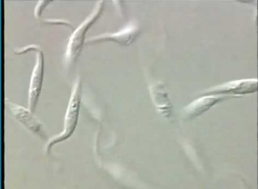 <ul><li><p>Are also hemoflaggellates like <em>Leishmania</em>. The major difference between the two lies in their diagnostic stages, which is the amastigote for <em>Leishmania </em>and the trypomastigotigot for the trypanosome</p></li><li><p>The trypomastigotes are curved, assuming the shape of letters C, S, or U.</p></li><li><p>The trypomastigotes are visible in the peripheral blood</p></li></ul><p></p>