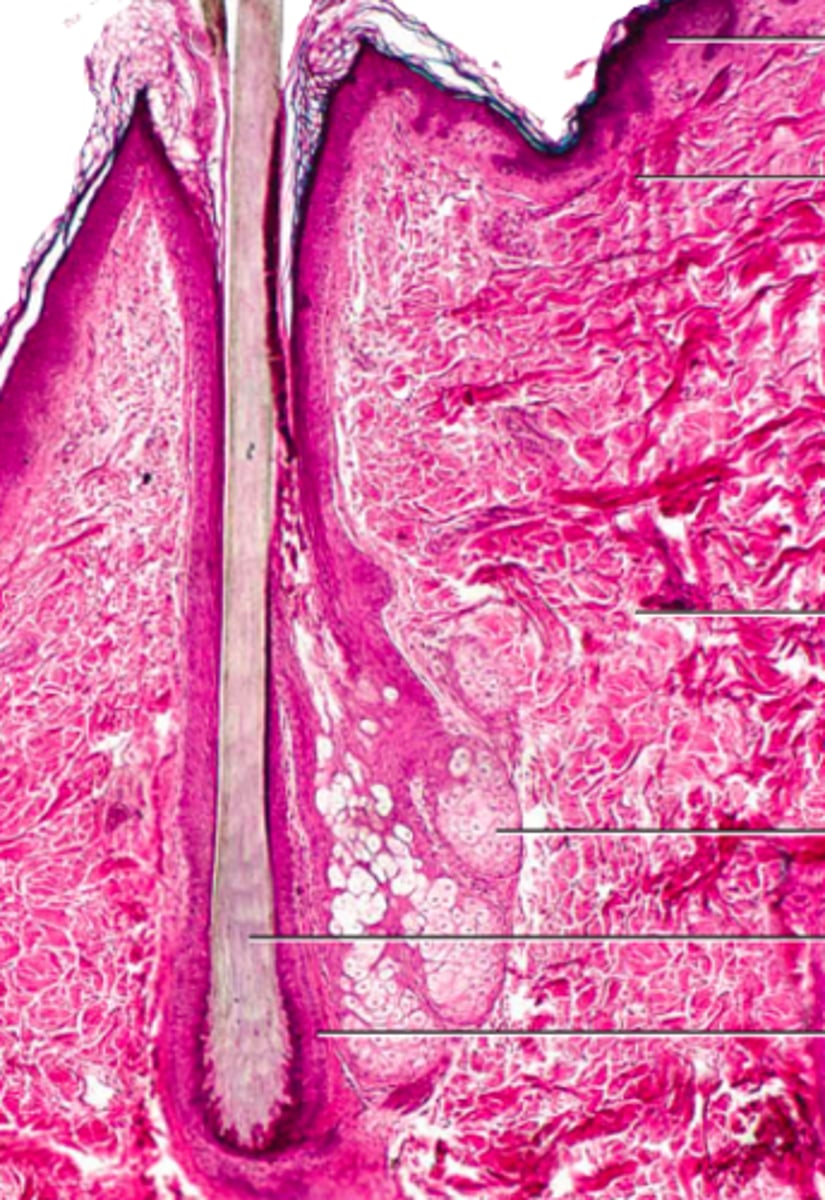 <p>bottom right arrow</p>