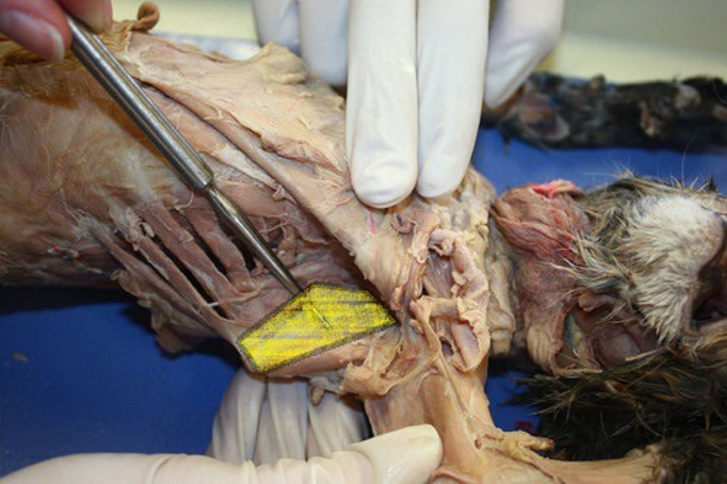<p>What muscle is this?</p><p>Origin?</p><p>Insertion?</p><p>Action?</p><p>Nerve?</p>