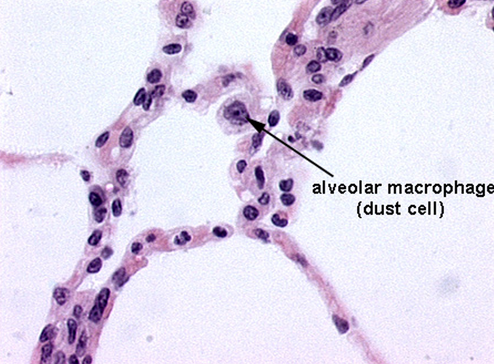 <p>Alveoli</p>