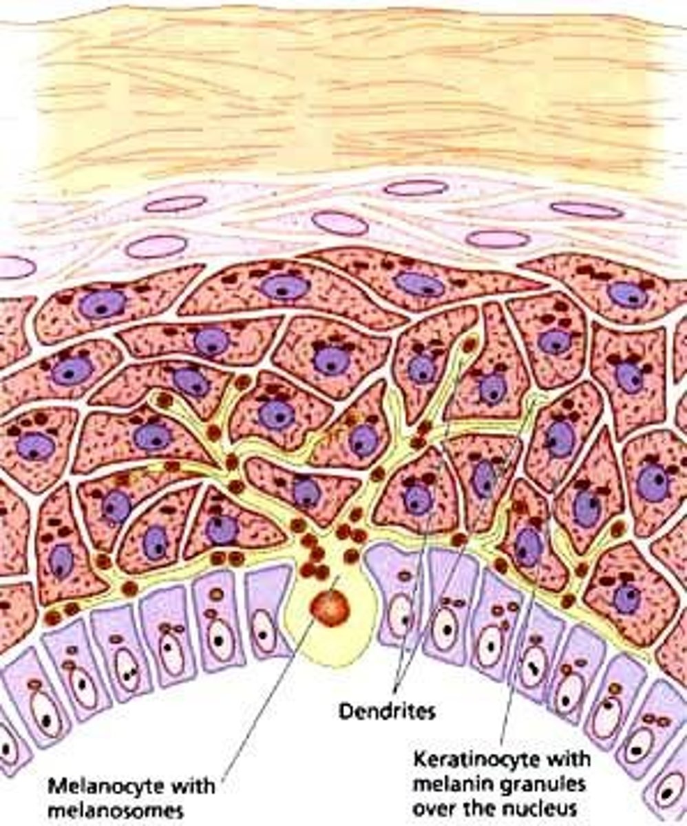 <p>Genetic condition causing lack of melanin in skin.</p>