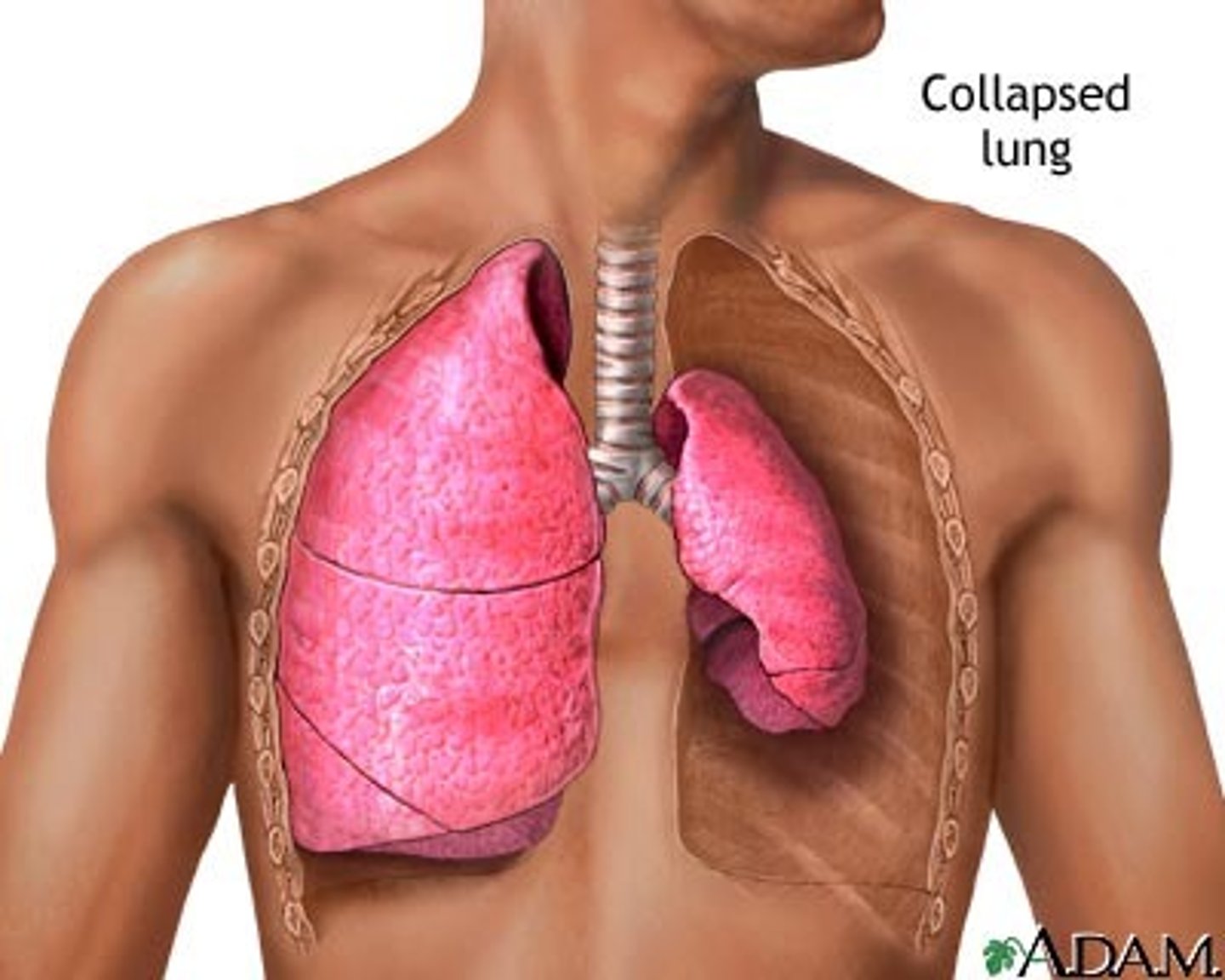 <p><strong><span class="bgB">-atelectasis</span></strong> (biggest concern; MC complication)</p><p>-pulmonary edema</p><p>-pneumonia</p>