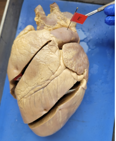 <p>pulmonary artery </p>
