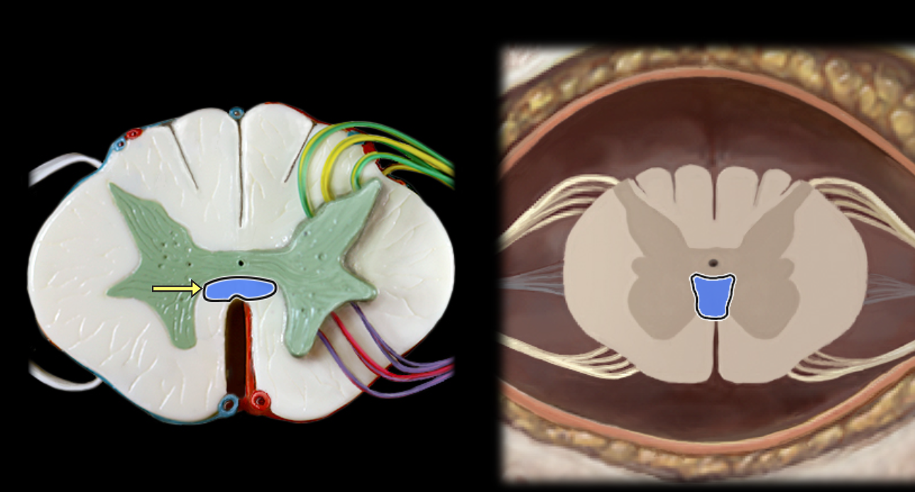 <p>Anterior commissure</p>