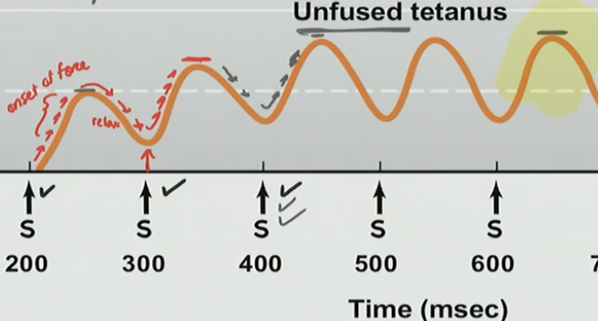 <p>Unfused Tetany</p>