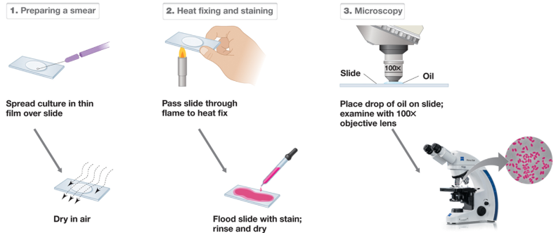 <p><span>No cover slips because it creates too wide of a slide so the oil immersion can’t see anything&nbsp;</span></p><ol><li><p><span>Take glass slide and apply culture containing bacteria in center of the slide&nbsp;</span></p></li><li><p><span>Use an inoculating loop to transfer it&nbsp;</span></p></li><li><p><span>Spread very thin</span></p></li><li><p><span>We need it to dry completely</span></p><ol><li><p><span>If we move too quickly, we will boil the bacteria if we heat fix&nbsp;</span></p></li><li><p><span>When you boil them, it will burst open and distort what the bacteria looks like&nbsp;</span></p></li></ol></li><li><p><span>Stain to create contrast so we can visualize microbes when we get to the light microscope</span></p></li></ol><p></p>