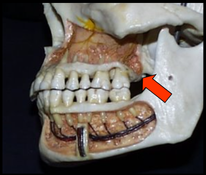 <p><span>A rounded prominence of bone that extends posterior to the third molar region.</span></p>