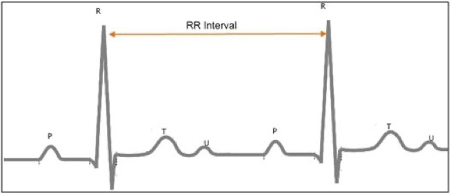 <p>What can be done if the R-waves are inverted?</p>
