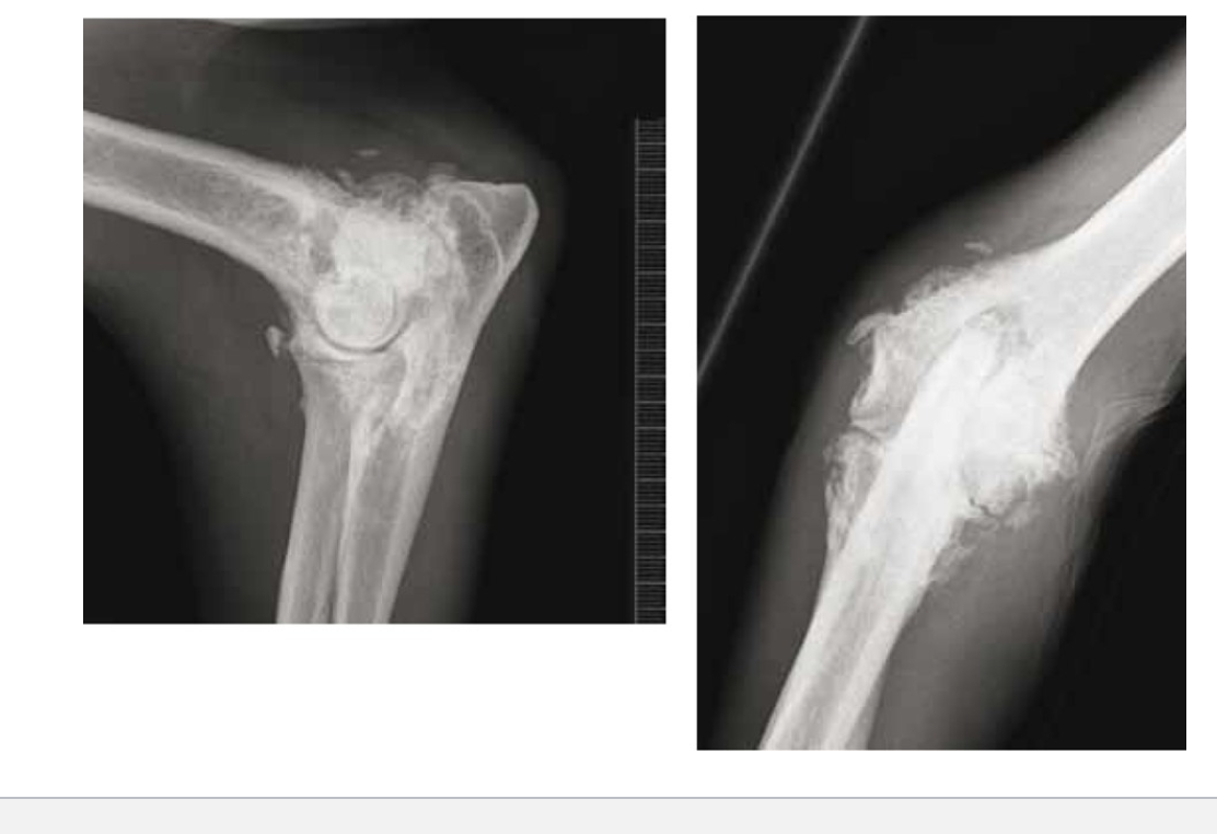 <p>Clinical signs of OA</p>