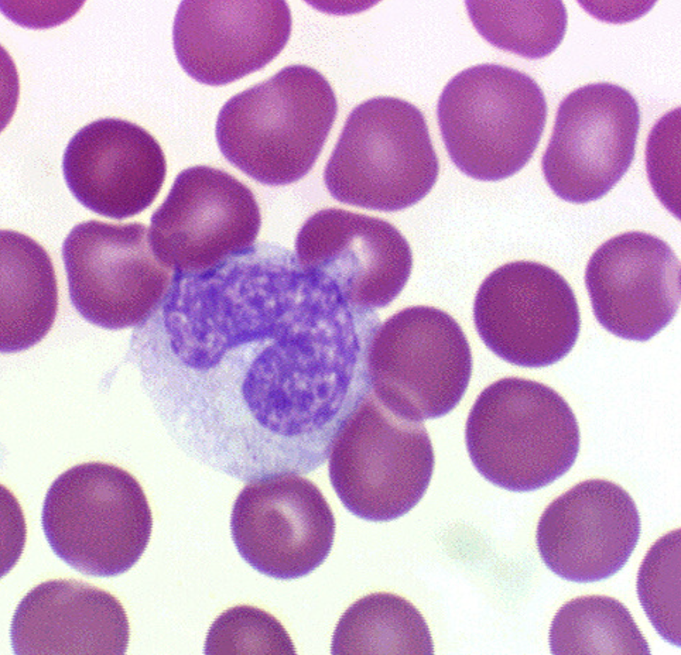\-3-8% \n -Large in size \n -C shaped nucleus \n -Wandering macrophages
