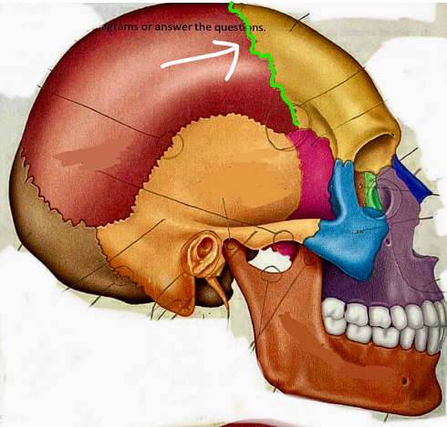 <p>What suture is this?</p>