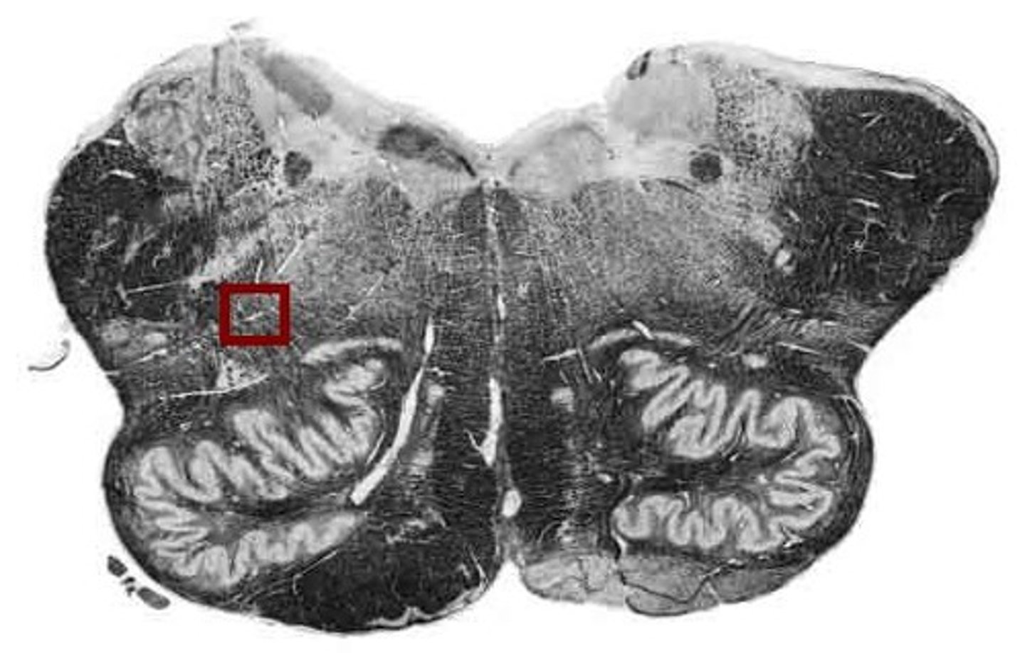 <p>involved in swallowing (deglutition) &amp; vocalization</p>