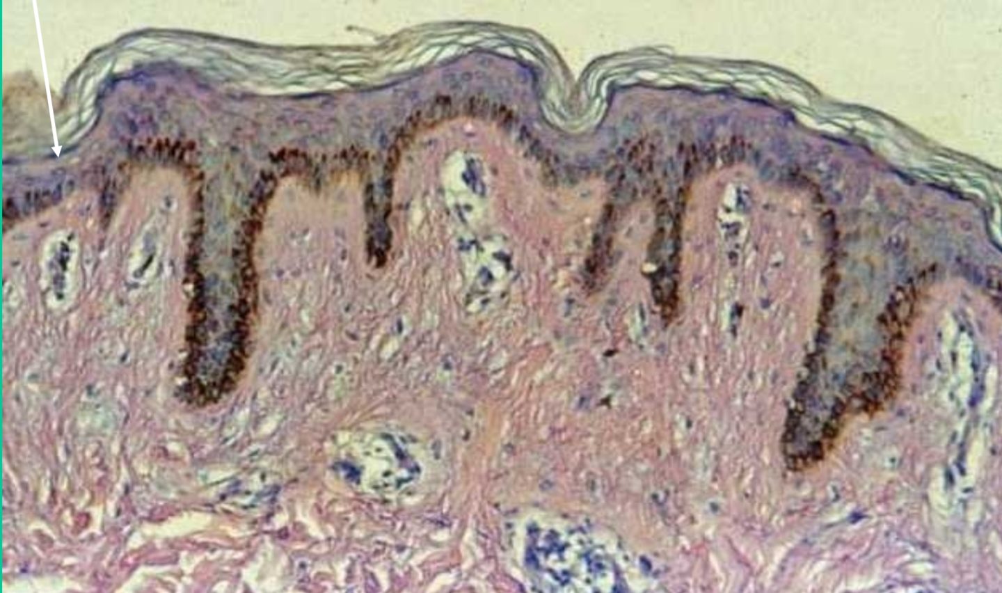 <p>Where are stratified squamous epithelium tissues found?</p>