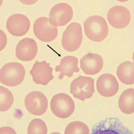 <p>What is the shape of this erythrocyte?</p>