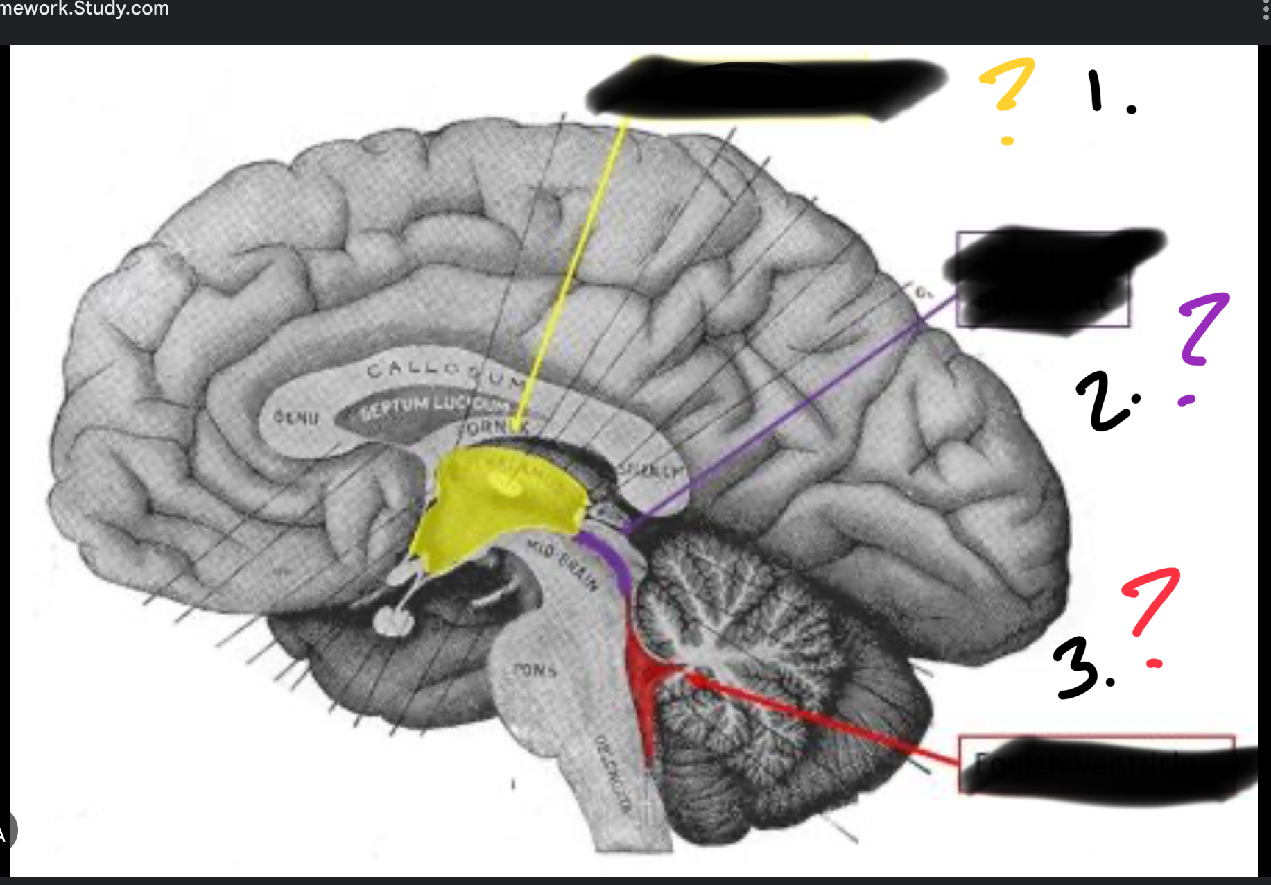 <p>Third ventricle</p>