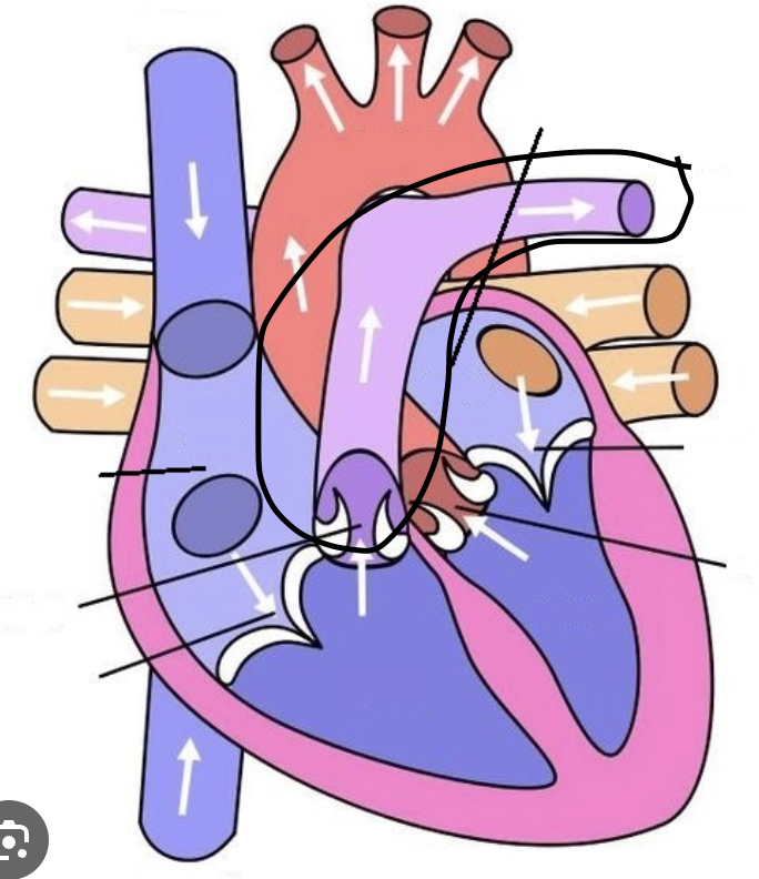 <p>Artery that carries DOB from heart to the lungs</p>