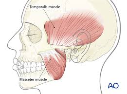 <p>closes jaw (another chewing muscle) </p>