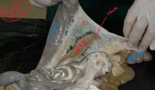 <p>The structures of ileum?</p>