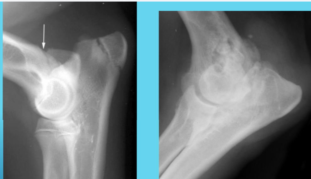 <p>Arthrosis</p>
