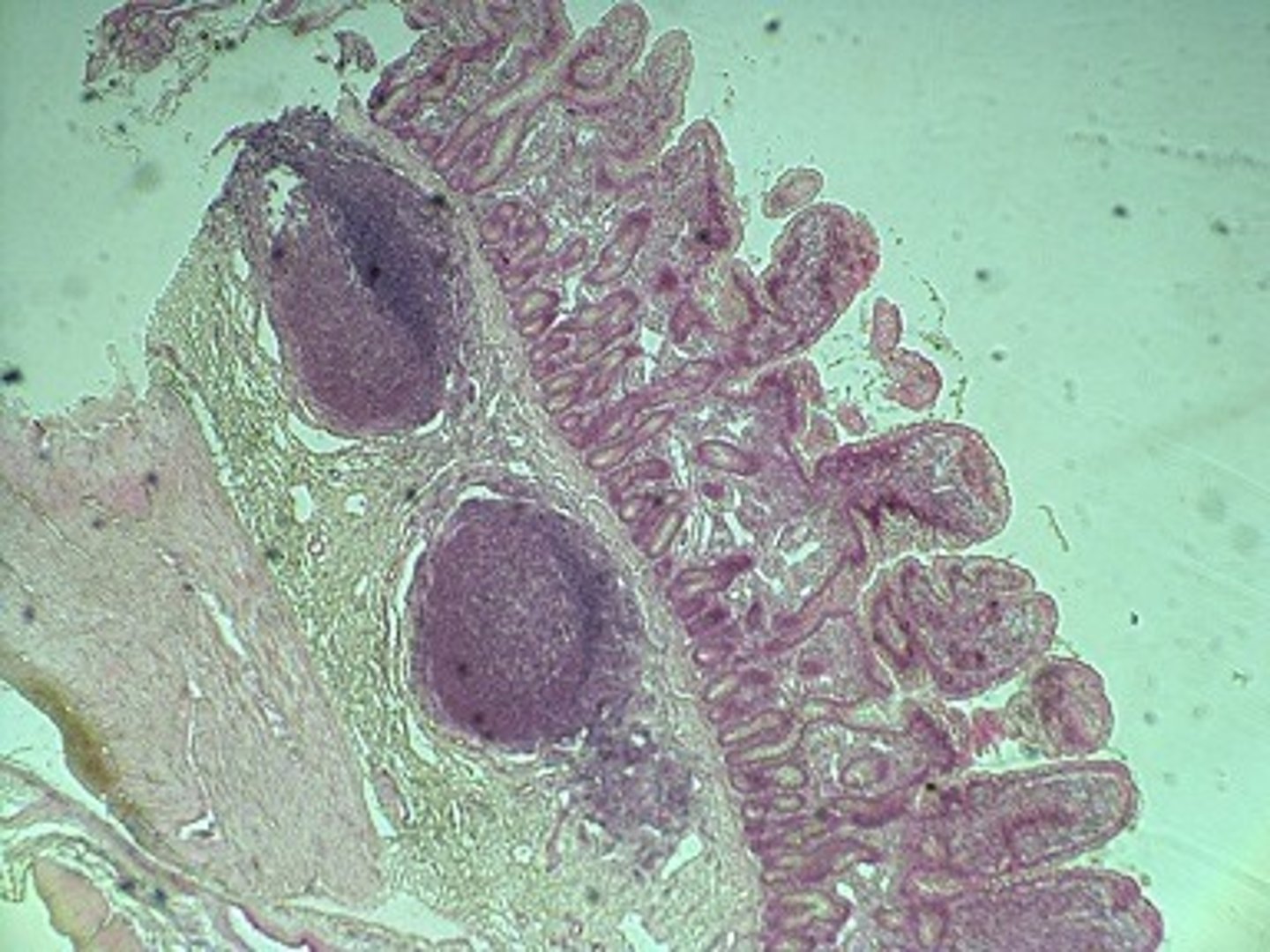 <p>This is a slide of what region of the GI tract?</p>