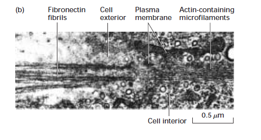 <p>Electron micrograph of the junction of fibronectin and actin fibers in a cultured fibroblast</p>