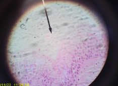 <p>Location: Respiratory tract and oviducts</p><p>Function: To move materials along the outer surface of the cell</p>