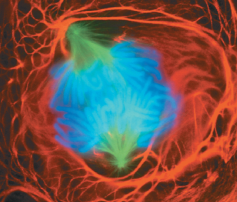 <p>What stage of mitosis is shown here?</p>