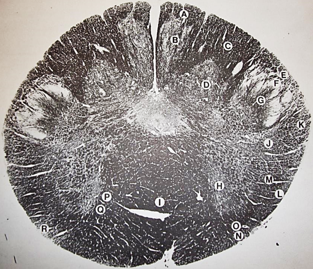 <p>H</p>