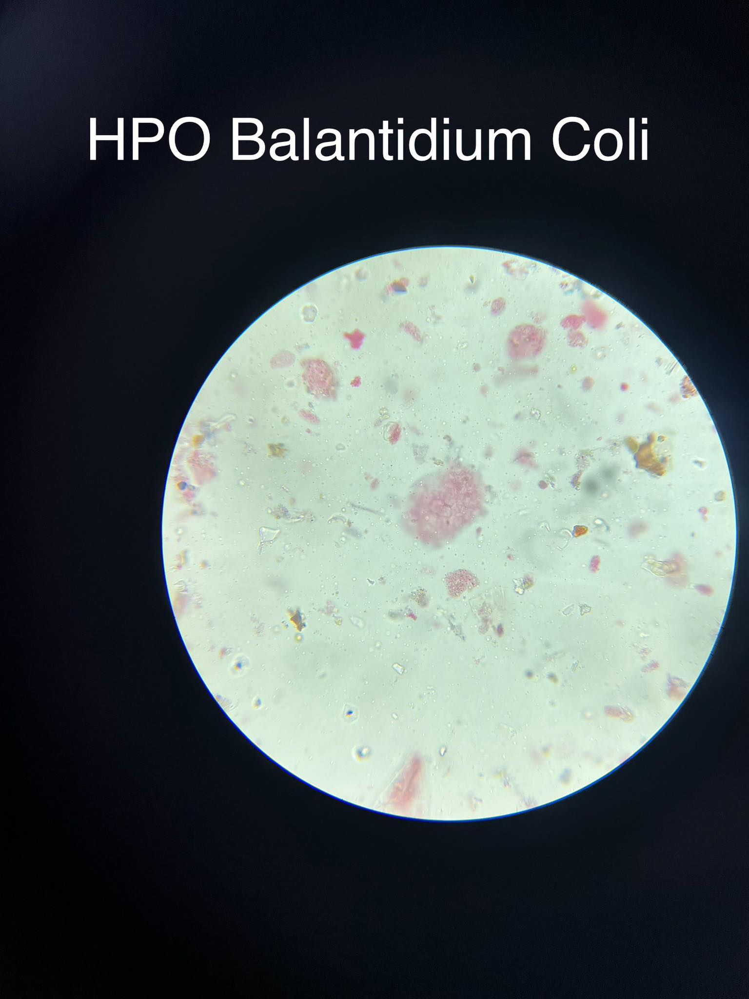 <p>Balantidium coli</p>