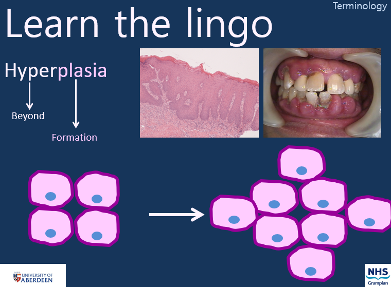 Tumour Pathology 14 Notes Knowt