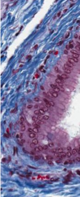 <p>What is the type of epithelium present in the image?</p>