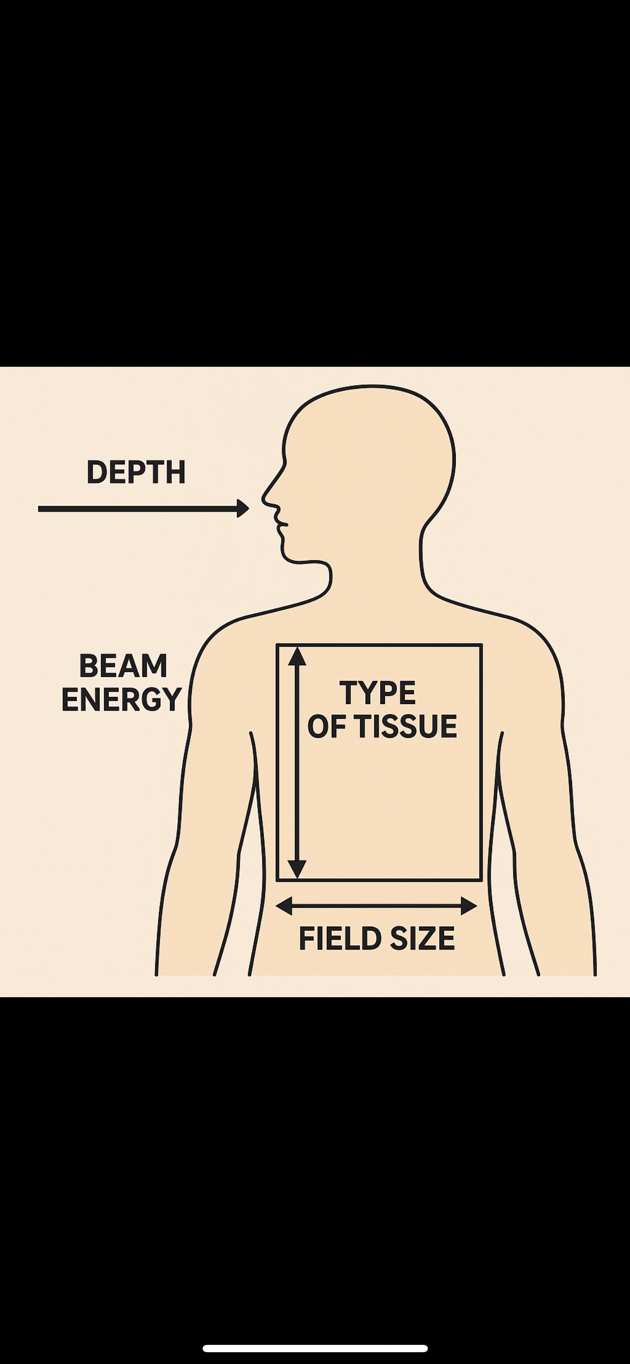 <ol><li><p>DEPTH</p></li></ol><p>The deeper the point, the more the radiation has to travel, which can reduce the dose delivered to the target.- EFFECTS DOSE</p><p>E - 2. Beam Energy</p><p>DISTANCE FROM SOURCE</p><p>Higher energy beams penetrate deeper tissues but may deposit less EFFECTS DOSE</p><p>T - 3. Type of Tissue (Density of Tissue)</p><p>Different tissues absorb radiation differently.- EFFECTS WHERE DOSE GOES</p><p>F - 4. Field Size</p><p>Larger treatment fields cover a bigger area, affecting the dose distribution and intensity.</p><p>SCATTER- EFFECTS DOSE</p>