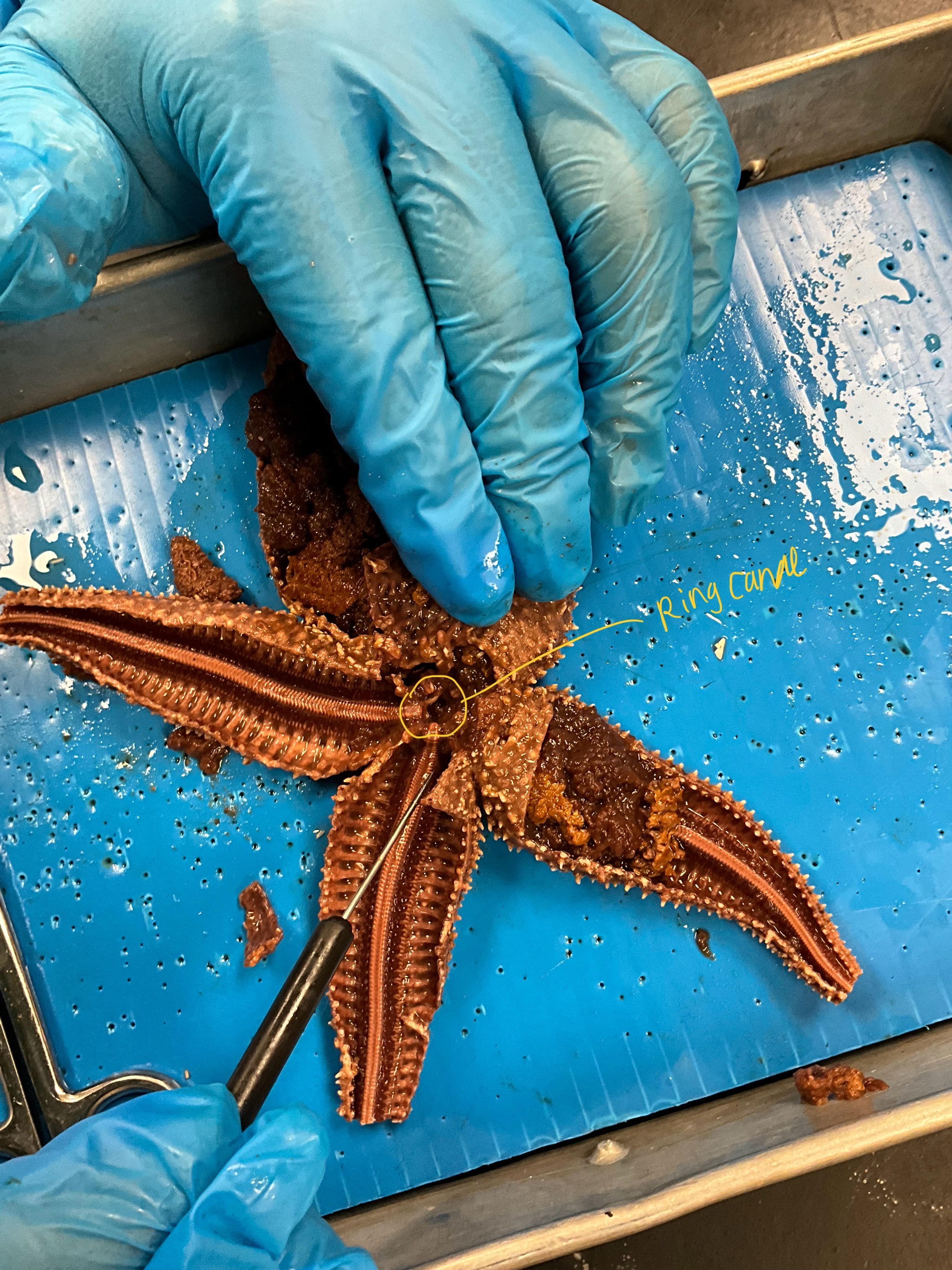 <p>ring canal&nbsp;</p>