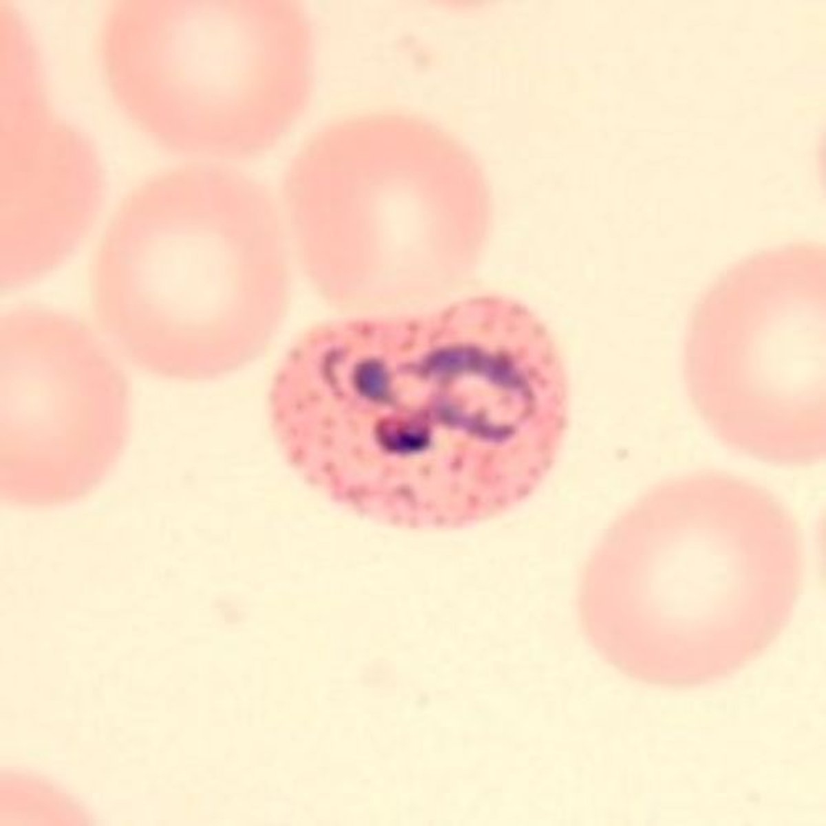 <p>Enlarged RBCs with "Schüffner's dots" (red granules)</p>