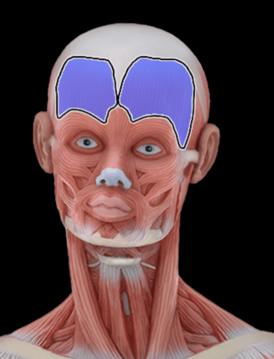 <p>What Muscle Is Highlighted?</p>