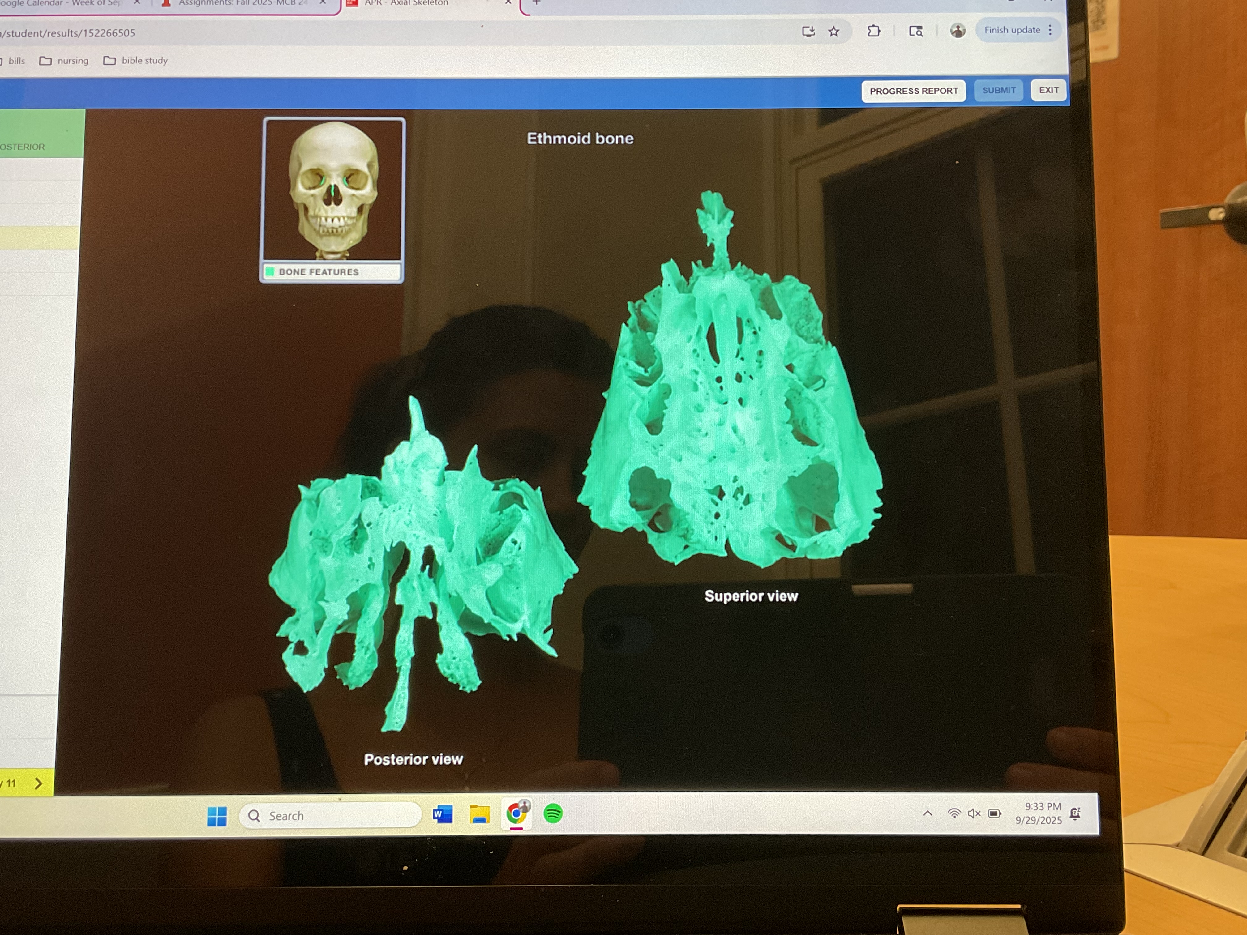 <p>Ethmoid bone </p>