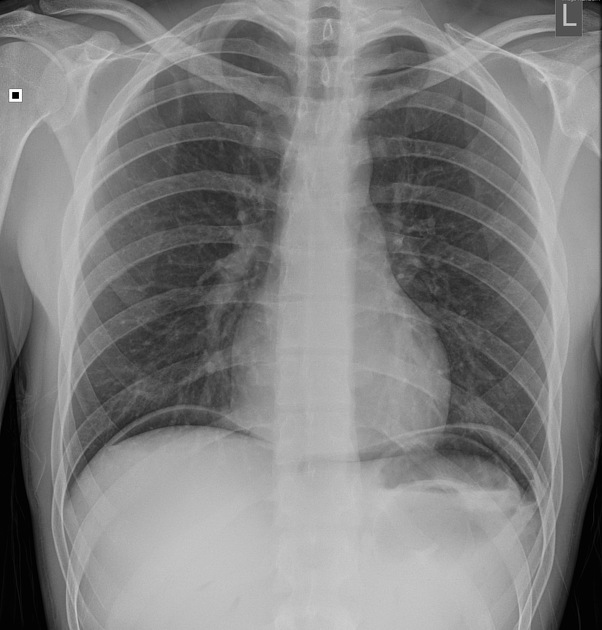 <p>Describe the abnormality demonstrated. </p>