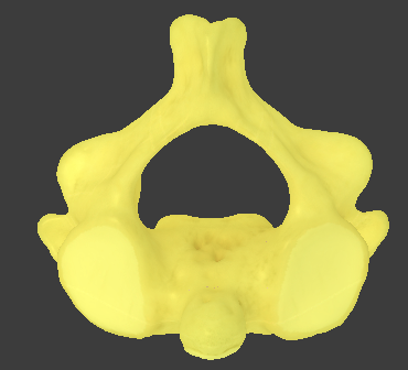 <ul><li><p>C2</p></li><li><p>Inferior articular facet of the atlas articulates with the superior articular facet of the axis at the atlantoaxial joint</p></li><li><p>responsible for head rotation</p></li></ul><p></p>