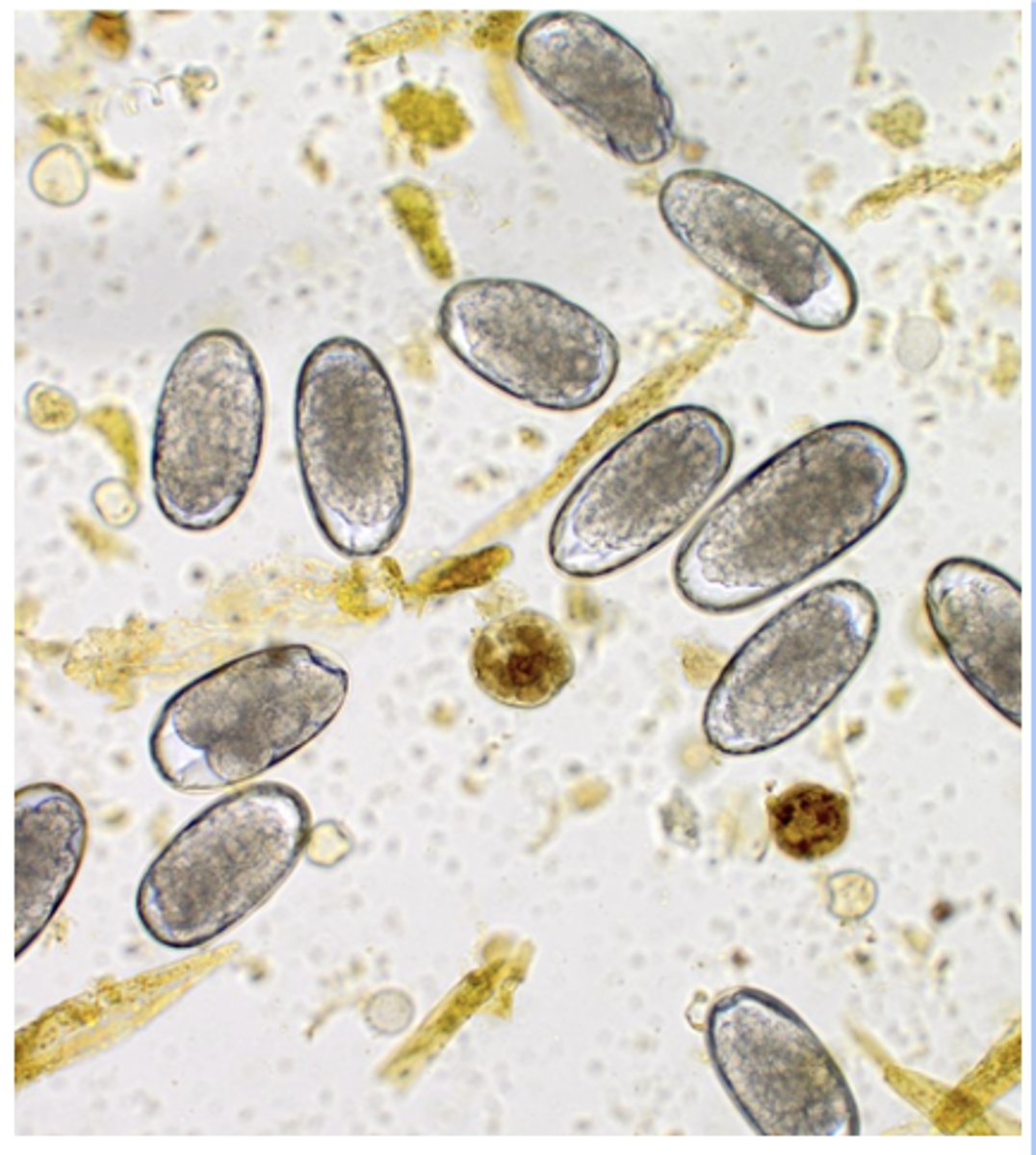 <p>What parasite group is most likely associated with eggs like these (90x54um) when they occur on the fecal flotation of a 15-week-old foal?</p>